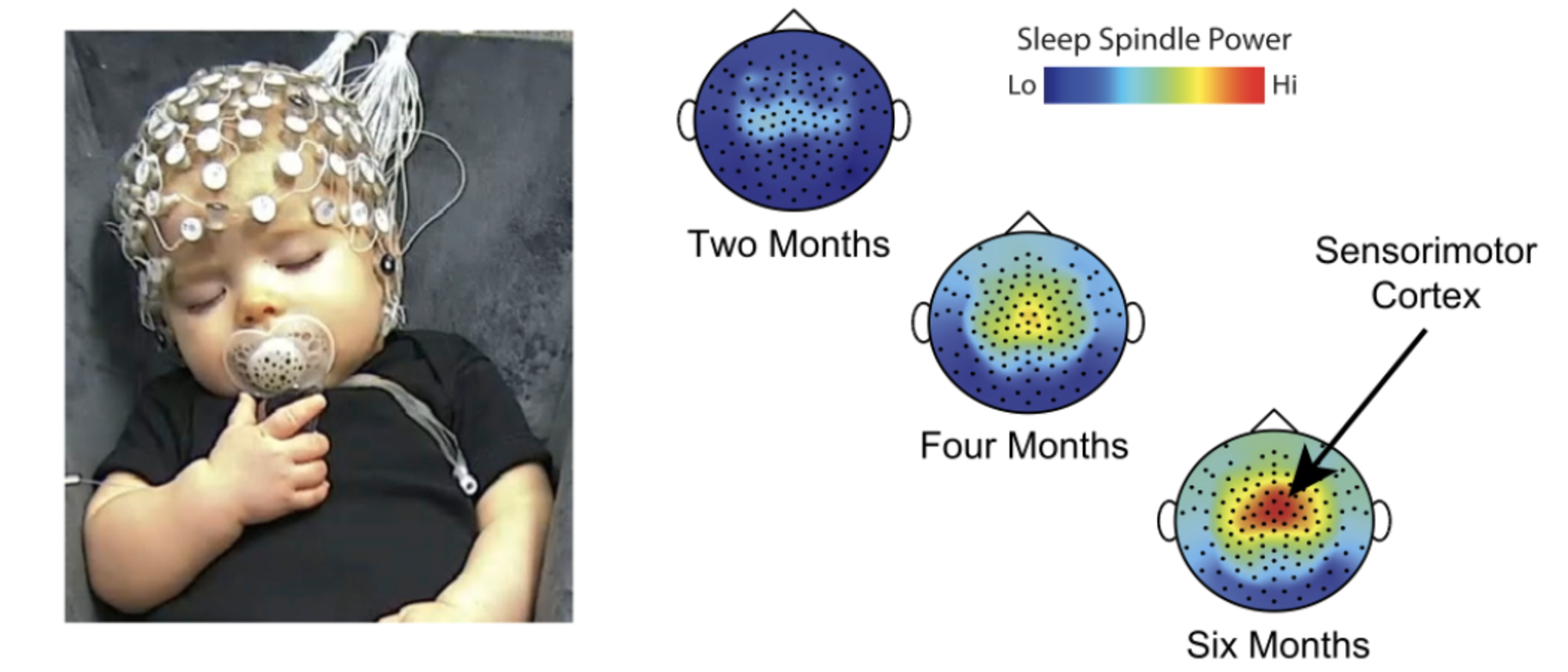 Image of a baby undergoing EEG to study the neural basis of sleep.